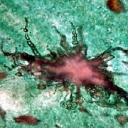 Microbial Fossil